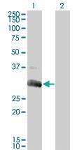 Anti-DGUOK Mouse Monoclonal Antibody [clone: 3E9]