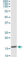 Anti-SLURP1 Mouse Monoclonal Antibody [clone: 4D1]