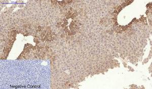 Immunohistochemical analysis of paraffin-embedded mouse liver tissue using Anti-Collagen I Antibody at 1:200 (4°C overnight). Negative control was secondary antibody only.