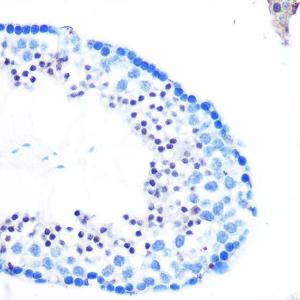 Immunohistochemistry analysis of paraffin-embedded mouse testis using Anti-hHR23b Antibody (A306047) at a dilution of 1:100 (40x lens) Perform microwave antigen retrieval with 10 mM PBS buffer pH 72 before commencing with IHC staining protocol