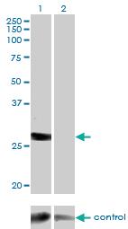 Anti-DGUOK Mouse Monoclonal Antibody [clone: 3E9]