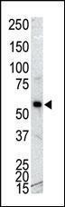 Anti-CAMK1G Rabbit Polyclonal Antibody (AP (Alkaline Phosphatase))