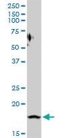 Anti-PTGES Rabbit Polyclonal Antibody