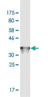 Anti-STIP1 Mouse Monoclonal Antibody [clone: 1C6]