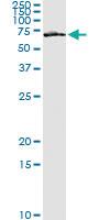 Anti-FZD5 Antibody Pair