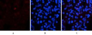 Immunofluorescence analysis of rat lung tissue using Anti-Collagen I Antibody (red) at 1:200 (4°C overnight). Cy3 labelled secondary antibody was used at 1:300 (RT 50min). Panel A: Target. Panel B: DAPI. Panel C: Merge.