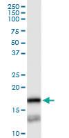 Anti-PTGES Rabbit Polyclonal Antibody