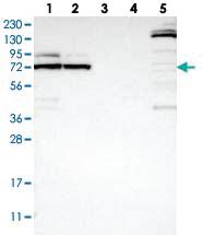 Anti-METTL16 Rabbit Polyclonal Antibody