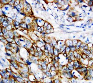 Anti-beta Catenin Rabbit Polyclonal Antibody