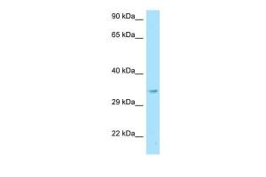 Anti-GNB2L1 Rabbit Polyclonal Antibody