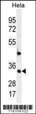 Anti-MED7 Rabbit Polyclonal Antibody (PE (Phycoerythrin))