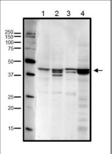 Anti-RRM2 antibody