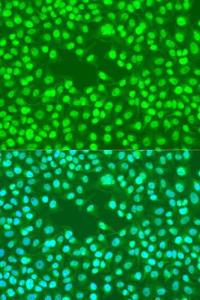 Immunofluorescence analysis of U2OS cells using Anti-hHR23b Antibody (A306047) at a dilution of 1:100 DAPI was used to stain the cell nuclei (blue)