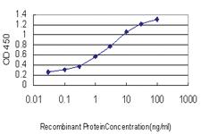 Anti-SLURP1 Mouse Monoclonal Antibody [clone: 4D1]