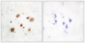 Immunohistochemical analysis of paraffin-embedded human brain tissue using Anti-CaMK1-beta Antibody. The right hand panel represents a negative control, where the Antibody was pre-incubated with the immunising peptide