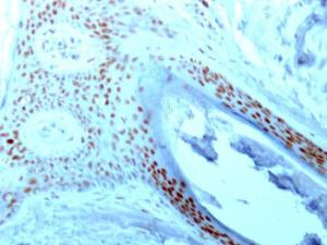 Immunohistochemical analysis of formalin-fixed, paraffin-embedded human skin using Anti-Nucleolin Antibody [NCL/902]