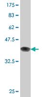 Anti-DCP1A Mouse Monoclonal Antibody [clone: 2F11]