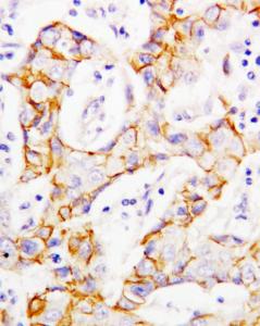 Anti-beta Catenin Rabbit Polyclonal Antibody