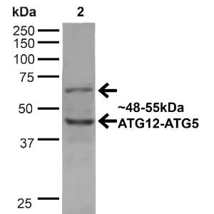 Western blot analysis of human Cervical cancer cell line (HeLa) lysate showing detection of ~48 and 55kDa ATG12 protein using Anti-ATG12 Antibody (A304899) at 1:1000 for 1 hour at room temperature