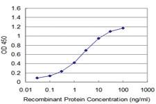 Anti-MCM3 Mouse Monoclonal Antibody [clone: 2A11]