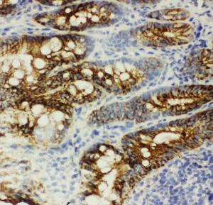 Anti-beta Catenin Rabbit Polyclonal Antibody