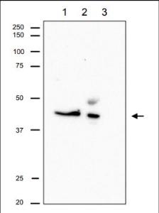 Anti-RRM2 antibody