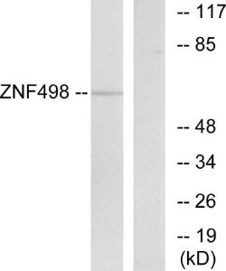 Western blot analysis of lysates from COS7 cells using Anti-ZNF498 Antibody The right hand lane represents a negative control, where the antibody is blocked by the immunising peptide