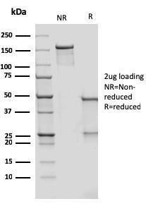 SDS-PAGE analysis of Anti-DC-SIGN Antibody [rC209/1781] under non-reduced and reduced conditions; showing intact IgG and intact heavy and light chains, respectively. SDS-PAGE analysis confirms the integrity and purity of the antibody