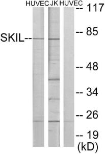 Western blot analysis of lysates from HUVEC and Jurkat cells using Anti-SKIL Antibody. The right hand lane represents a negative control, where the antibody is blocked by the immunising peptide.