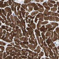 Anti-METTL16 Rabbit Polyclonal Antibody