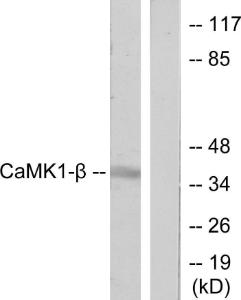 Western blot analysis of lysates from LOVO cells, treated with H2O2 100 µM 30' using Anti-CaMK1-beta Antibody. The right hand lane represents a negative control, where the Antibody is blocked by the immunising peptide