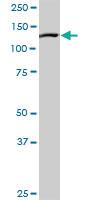 Anti-NLRP2 Rabbit Polyclonal Antibody