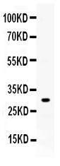 Western blot analysis of ZWINT expression in rat skeletal muscle extract (lane 1). ZWINT at 31KD was detected using rabbit anti- ZWINT Antigen Affinity purified polyclonal antibody (Catalog # PB10018) at 0.5 ?g/ml. The blot was developed using chemiluminescence (ECL) method (Catalog # EK1002).