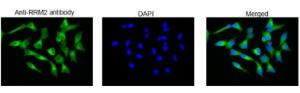 Anti-RRM2 antibody