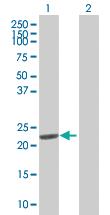 Anti-DHFR Mouse Polyclonal Antibody