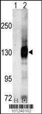 Anti-CASK Rabbit Polyclonal Antibody (APC (Allophycocyanin))