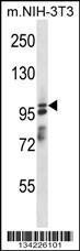 Anti-ASAP1 Rabbit Polyclonal Antibody (HRP (Horseradish Peroxidase))