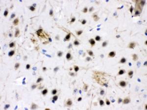 ZWINT was detected in paraffin-embedded sections of mouse brain tissues using rabbit anti- ZWINT Antigen Affinity purified polyclonal antibody (Catalog # PB10018) at 1 ?g/ml. The immunohistochemical section was developed using SABC method (Catalog # SA1022).