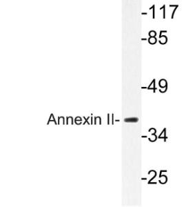 Western blot analysis of lysate from HeLa cells using Anti-Annexin II Antibody