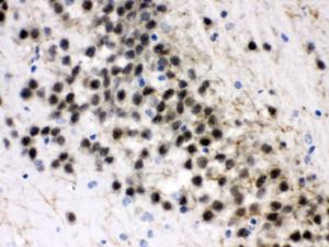 ZWINT was detected in paraffin-embedded sections of rat brain tissues using rabbit anti- ZWINT Antigen Affinity purified polyclonal antibody (Catalog # PB10018) at 1 ?g/ml. The immunohistochemical section was developed using SABC method (Catalog # SA1022).