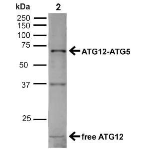 Western blot analysis of human Cervical cancer cell line (HeLa) lysate showing detection of ~15kDa ATG12 protein using Anti-ATG12 Antibody (A304900) at 1:1,000 for 1 hour at room temperatur