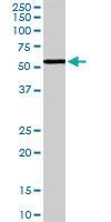 Anti-VPS45 Goat Polyclonal Antibody