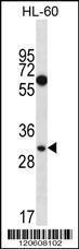 Anti-MED8 Rabbit Polyclonal Antibody