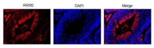 Anti-RRM2 antibody