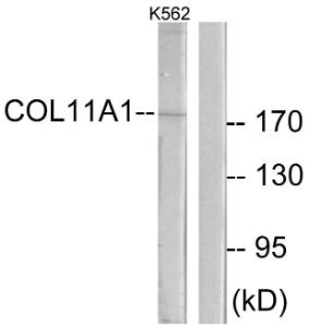 Western blot analysis of lysates from K562 cells using Anti-Collagen XI alpha1 Antibody. The right hand lane represents a negative control, where the antibody is blocked by the immunising peptide.