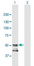 Anti-GCNT4 Mouse Polyclonal Antibody