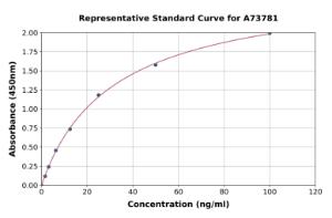 Representative standard curve for Human Anti-NMDAR Antibody ELISA kit