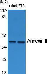 Western blot analysis of various cells using Anti-Annexin II Antibody