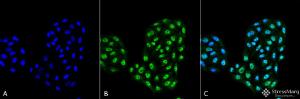 Immunocytochemistry/Immunofluorescence analysis of human cervical cancer cell line (HeLa), fixed in 4% formaldehyde for 15 min at room temperature, using Anti-ATG12 Antibody (A304900), at 1:100 for 60 minutes at room temperatur