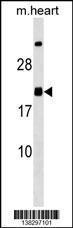 Anti-MED9 Rabbit Polyclonal Antibody (APC (Allophycocyanin))